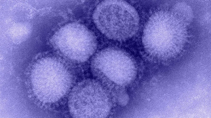 В 2025 году России угрожает свиной грипп H1N1