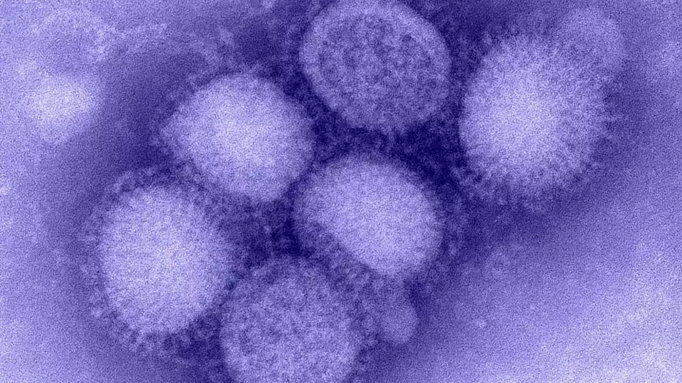 В 2025 году России угрожает свиной грипп H1N1