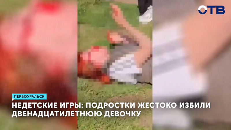 Подростки жестоко избили двенадцатилетнюю девочку в Первоуральске