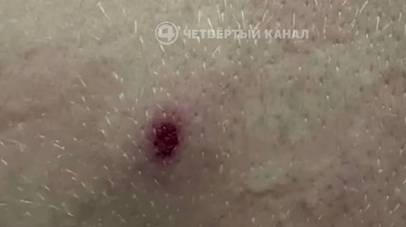 "У ребёнка четыре раны": детей обстреляли из травмата в Екатеринбурге